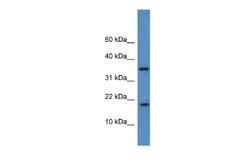 WW domain binding protein 5 Rabbit anti-Human, Polyclonal, Novus Biologicals 0.1 mL | Buy Online | Novus Biologicals | Fisher Scientific